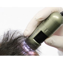 Video Tricoscop - Microscop tricologie  - TrichoScope Basic Video Tricoscop - Microscop tricologie  - TrichoScope Basic